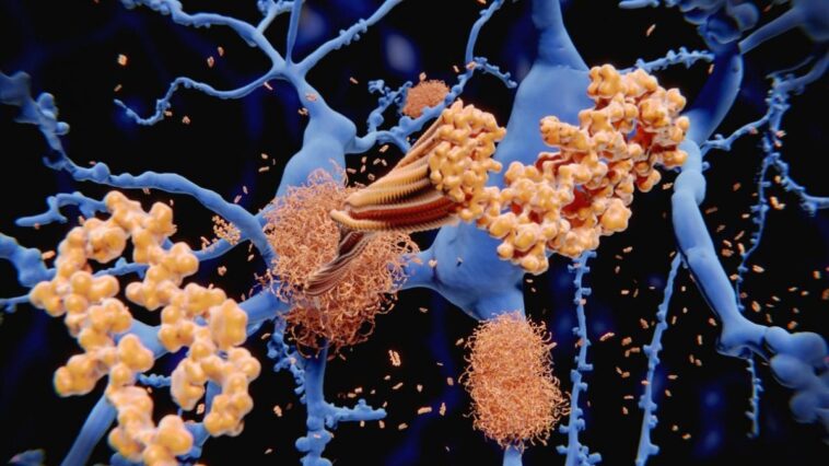 Le signal caché qui déclenche Alzheimer : la découverte des chercheurs sur la formation des plaques 1 Un signal cellulaire peut induire l'agrégation de peptides de bêta-amiloïde (en jaune) dans le cerveau, accélérant la formation de plaques amyloïdes typiques de l'Alzheimer / Crédit : iStock