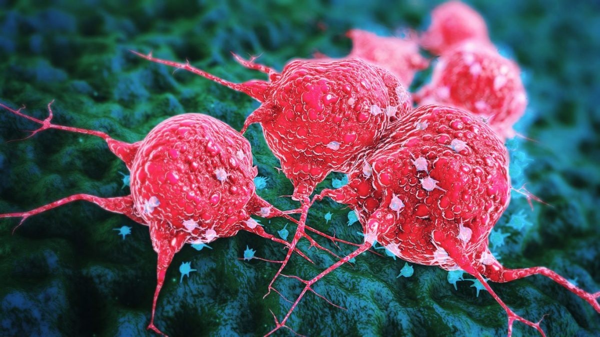 Six types de cancer en hausse chez les jeunes et les adultes : quelles sont les différences selon l'âge 2 Image