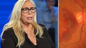 Mara Venier, 75 ans, a raconté souffrir de maculopathie essudative, une forme grave de dégénérescence maculaire liée à l'âge / Photo : Getty
