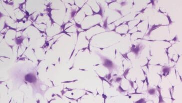 Un médicament courant contre l'hypertension stoppent les cellules d'un cancer cérébral mortel : une découverte fascinante 22 Les cellules du glioblastome bloquées par l'hydralazine, un médicament courant contre l'hypertension. Crédit : Kyosuke Shishikura