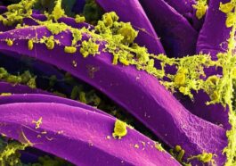 Yersinia pestis (en jaune), la bactérie qui cause la peste. Image au microscope électronique à balayage colorée numériquement / Crédit : NIAID/CDC