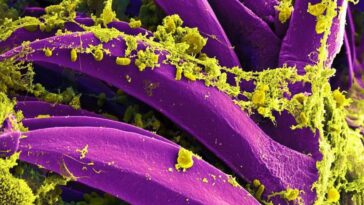 Des éruptions volcaniques oubliées pourraient avoir déclenché la Peste Noire : de nouvelles preuves scientifiques 5 Yersinia pestis (en jaune), la bactérie qui cause la peste. Image au microscope électronique à balayage colorée numériquement / Crédit : NIAID/CDC