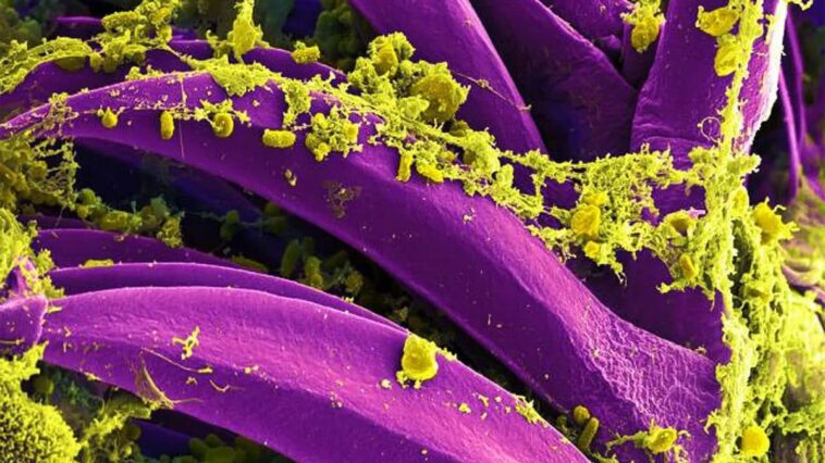 Des éruptions volcaniques oubliées pourraient avoir déclenché la Peste Noire : de nouvelles preuves scientifiques 1 Yersinia pestis (en jaune), la bactérie qui cause la peste. Image au microscope électronique à balayage colorée numériquement / Crédit : NIAID/CDC