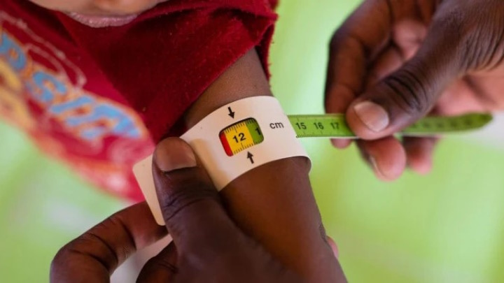 Nouveau type de diabète officiellement reconnu : Diabète de type 5 2 Nouveau type de diabete officiellement reconnu Diabete de type