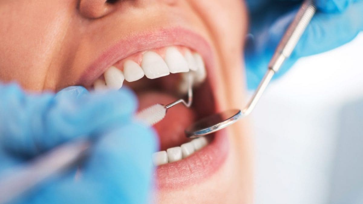 Un lien surprenant entre les gencives et les maladies cardiaques, selon les experts : "Le cœur et la bouche sont intimement liés" 2 Image