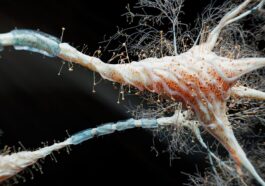 La perte des synapses est l'un des processus les plus étroitement liés au déclin de la mémoire dans l'Alzheimer / Image iStock