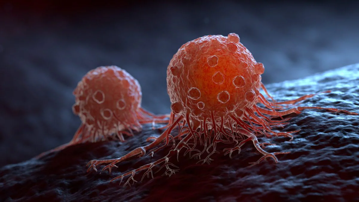 Cancer : des nanoparticules pour combattre les métastases et transformer la lutte contre les tumeurs 2 Image