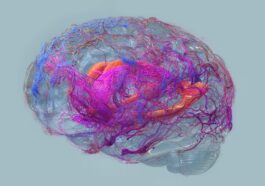 Découverte d'un nouveau signe précurseur de l'Alzheimer : détectable des années avant l'apparition des symptômes 42 Représentation de l’activité électrique du cerveau détectée par des techniques de neuroimagerie, semblables à celles utilisées dans l'étude de l'Université Brown pour identifier un nouveau signal pouvant prévoir la progression de l'Alzheimer de plus de deux ans / Crédit : iStock.