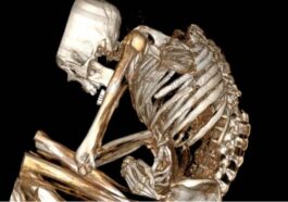 La scansioni della mummia dell’uomo. Crédit : Catalina Morales / Francisco Garrido / International Journal of Osteoarchaeology