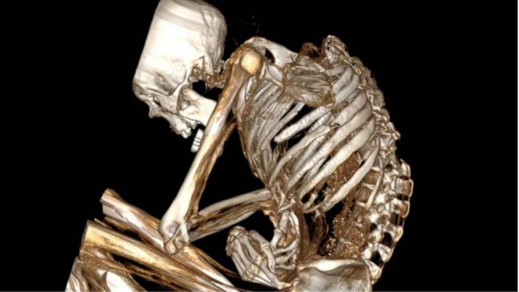 La scanographie d'une momie vieille de 1.100 ans révèle la véritable cause de sa mort tragique 1 La scansioni della mummia dell’uomo. Crédit : Catalina Morales / Francisco Garrido / International Journal of Osteoarchaeology