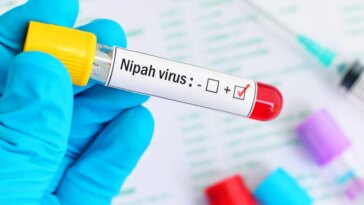 Pourquoi près de 100 personnes sont-elles en quarantaine en Inde : les clarifications de Rezza sur l’alerte concernant le virus Nipah 6 Image