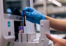 Certains signaux biologiques du Parkinson sont détectables dans le sang uniquement à un stade préclinique, avant l'apparition des symptômes moteurs, comme le montre une nouvelle étude publiée dans npj Parkinson’s Disease / Photo : iStock