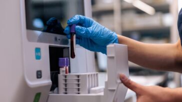 Signes de Parkinson dans le sang, mais uniquement avant l'apparition des symptômes : "Il existe une fenêtre temporelle précise" 22 Certains signaux biologiques du Parkinson sont détectables dans le sang uniquement à un stade préclinique, avant l'apparition des symptômes moteurs, comme le montre une nouvelle étude publiée dans npj Parkinson’s Disease / Photo : iStock