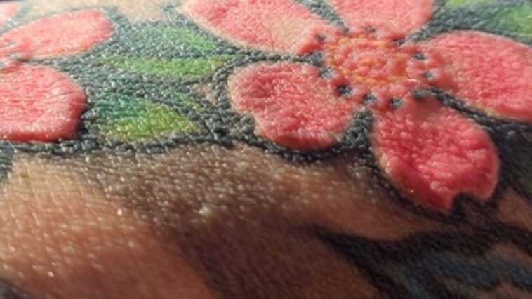 Symptômes inattendus des mois après un tatouage : l'histoire d'un trentenaire confronté à une ablation chirurgicale 1 Détail d'un tatouage avec de l'encre rouge