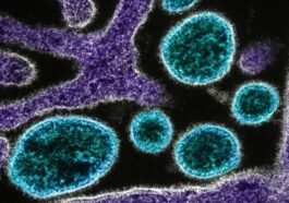Tout ce que vous devez savoir sur le virus Nipah