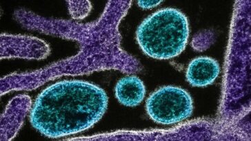 Tout ce que vous devez savoir sur le virus Nipah