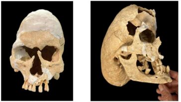 Un chevalier médiéval tombé au combat souffrait d'une étrange condition : la découverte fascinante des archéologues 15 Le crâne d'un chevalier tué au combat. Crédits : Ressiech et al./Heritage