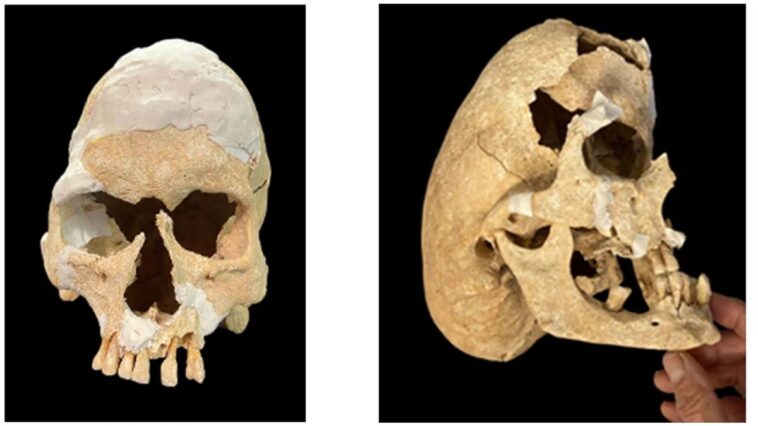 Un chevalier médiéval tombé au combat souffrait d'une étrange condition : la découverte fascinante des archéologues 1 Le crâne d'un chevalier tué au combat. Crédits : Ressiech et al./Heritage