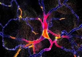 La maladie de Parkinson : bien plus qu'une simple perturbation du mouvement, elle impacte tout un réseau cérébral !