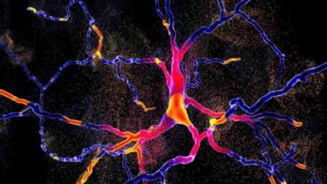La maladie de Parkinson : bien plus qu'une simple perturbation du mouvement, elle impacte tout un réseau cérébral !