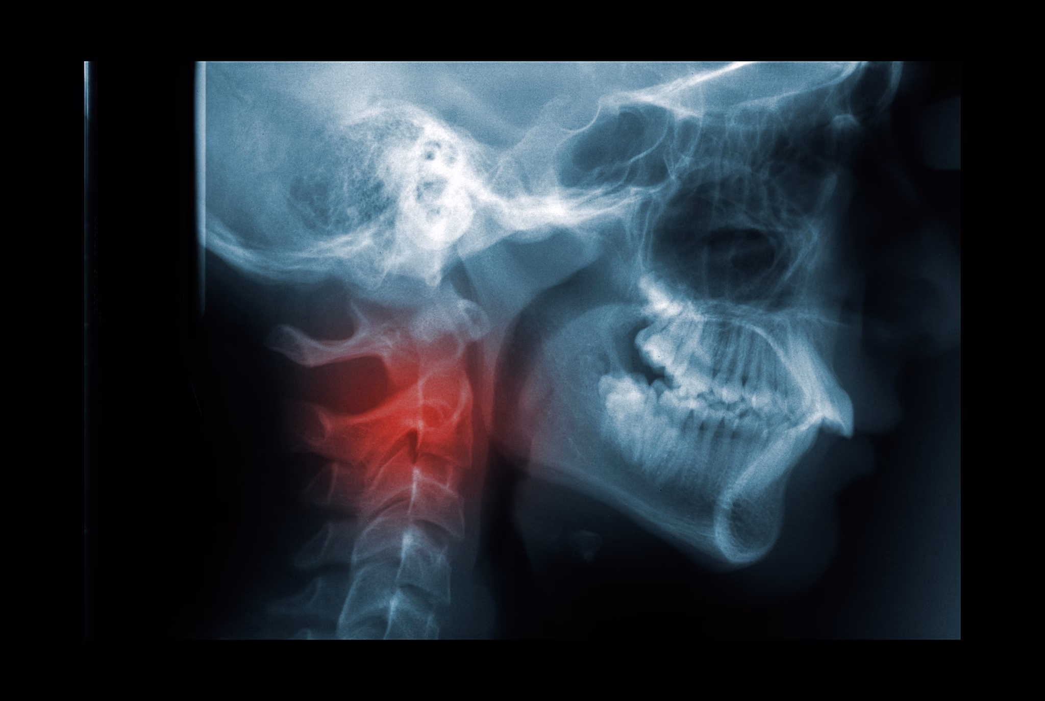 Un athlète découvre une blessure au cou aux Jeux Olympiques : le médecin révèle les raisons de ce phénomène surprenant 3 Image de référence