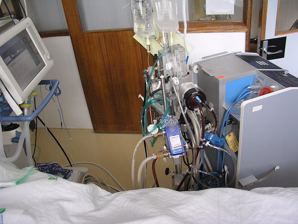 WIKIMEDIA | Une machine ECMO