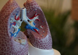 Vivre 48 heures sans poumons : une machine sur mesure maintient un homme en vie avant la greffe 91 Vivre 48 heures sans poumons : une machine sur mesure pour maintenir en vie un homme dont la cage thoracique est vide en attendant une transplantation