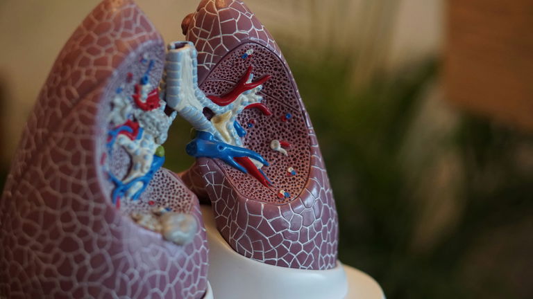 Vivre 48 heures sans poumons : une machine sur mesure maintient un homme en vie avant la greffe 2 Vivre 48 heures sans poumons : une machine sur mesure pour maintenir en vie un homme dont la cage thoracique est vide en attendant une transplantation