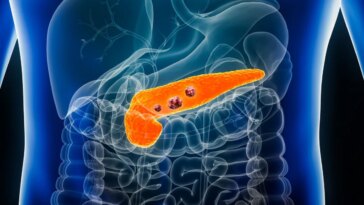 Cancer du pancréas : une étude sur des souris élimine les cellules précancéreuses avant qu'elles ne se transforment en tumeur 4 Image