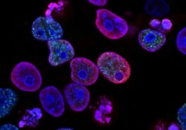 Les cellules cancéreuses sont capables d'utiliser les cellules saines pour se renforcer