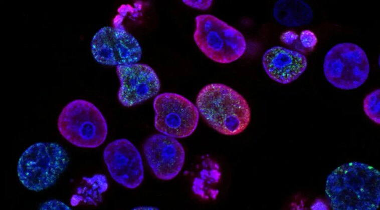 Un « minimétabolisme » caché au cœur de la cellule ouvre des portes contre le cancer 1 Les cellules cancéreuses sont capables d'utiliser les cellules saines pour se renforcer