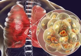 Ce nouveau capteur peut détecter la pneumonie par la respiration
