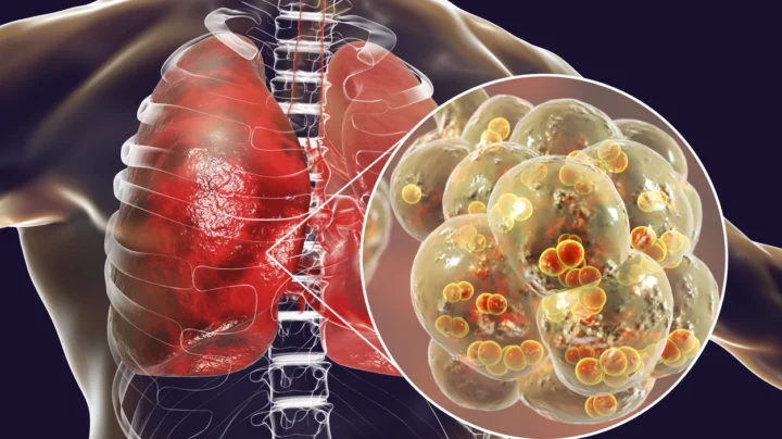 Ce nouveau capteur peut détecter la pneumonie par la respiration 2 Ce nouveau capteur peut detecter la pneumonie par la respiration.webp