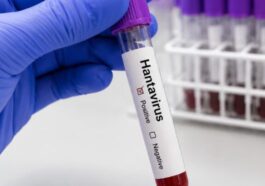 Premier cas suspect de hantavirus en Espagne