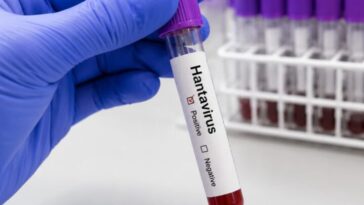Premier cas suspect de hantavirus en Espagne
