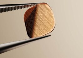L'Europe approuve un implant qui peut redonner la vue à des milliers de patients 75 L'Europe approuve un implant qui peut redonner la vue à des milliers de patients