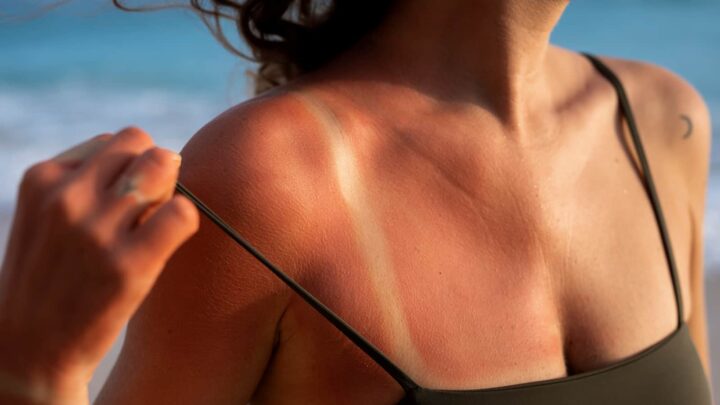 La tendance du bronzage sur les réseaux sociaux inquiète les dermatologues 3 1785616958 815 La tendance du bronzage sur les reseaux sociaux inquiete les