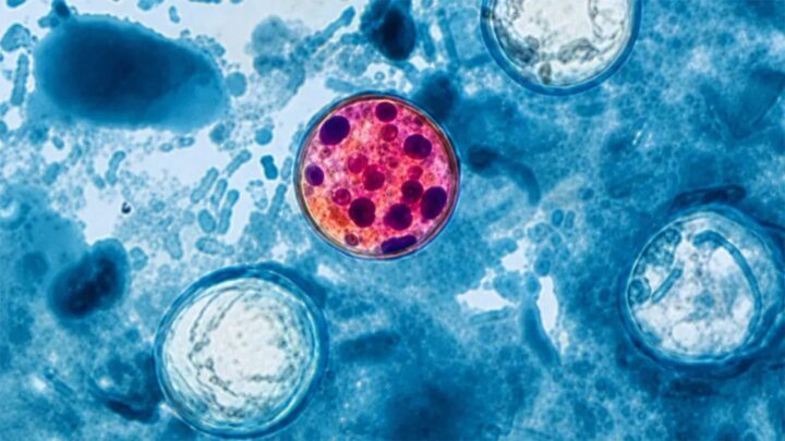 Cyclosporiase : pourquoi la laitue est-elle devenue une menace dans les supermarchés américains ? 4 1785843754 996 Cyclosporiase pourquoi la laitue est elle devenue une menace dans