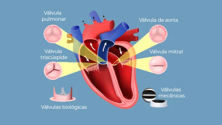 Les cardiologues redéfinissent l’insuffisance cardiaque : un cœur "normal" peut ne pas être sain 5 1787690993 734 Les cardiologues redefinissent linsuffisance cardiaque un coeur normal peut ne