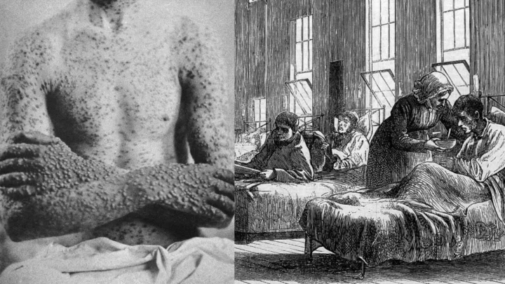 De 30 à plus de 80 ans : le secret médical qui a doublé notre espérance de vie 7 1787845546 233 De 30 a plus de 80 ans le secret