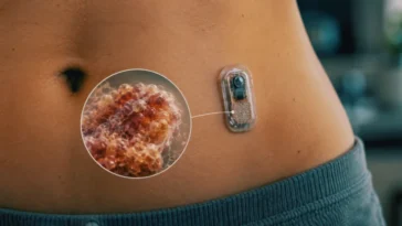 Adieu aux injections d'insuline ? Ce pancréas vivant miniature révolutionne le traitement 4 Adieu aux injections d'insuline ? Ce pancréas vivant miniature révolutionne le traitement
