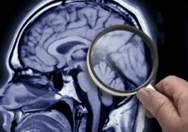 Une découverte à Lisbonne ouvre de nouvelles voies dans la recherche sur la maladie d'Alzheimer 71 Une découverte à Lisbonne ouvre de nouvelles voies dans la recherche sur la maladie d'Alzheimer